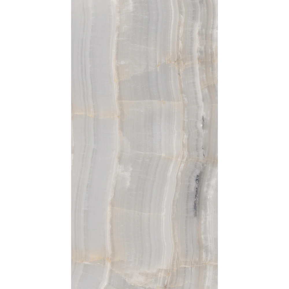Venetian 36 in Single Sink Bathroom Vanity in Espresso with Carrera White Marble Countertop